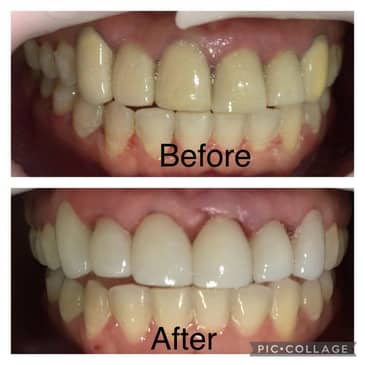 Slider image (3) Dental Clinic OCI Liberia